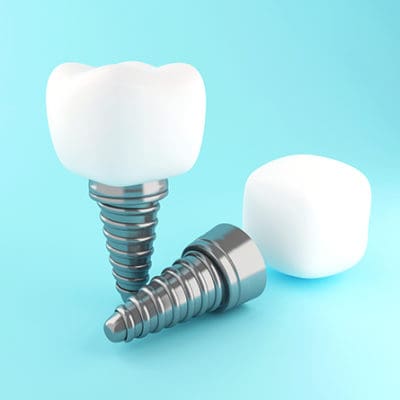 3D rendering of two dental tooth implants