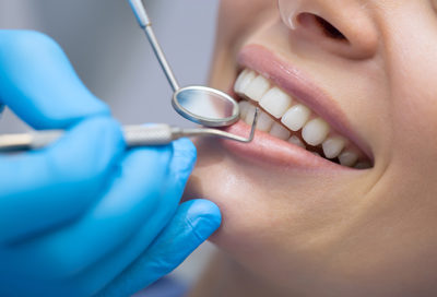 A close-up of a woman's mouth, with hands holding dental tools in front of her teeth.