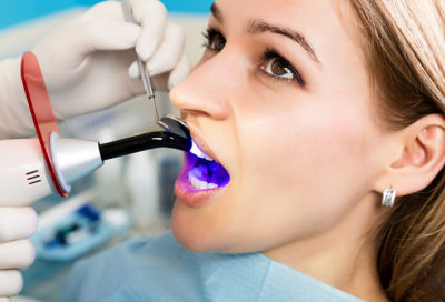A woman having a dental filling done.