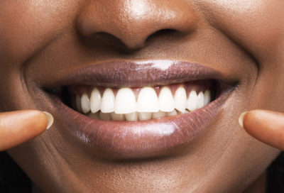 A smiling woman points at her white teeth