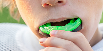 A white teenager puts a green mouthguard in his mouth