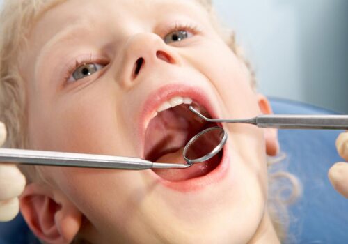 Our Role in Emergency Dentist Calgary