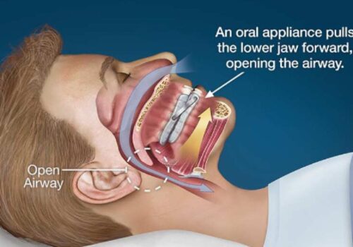 Improving Lives: Our Sleep Apnea Clinic in Calgary